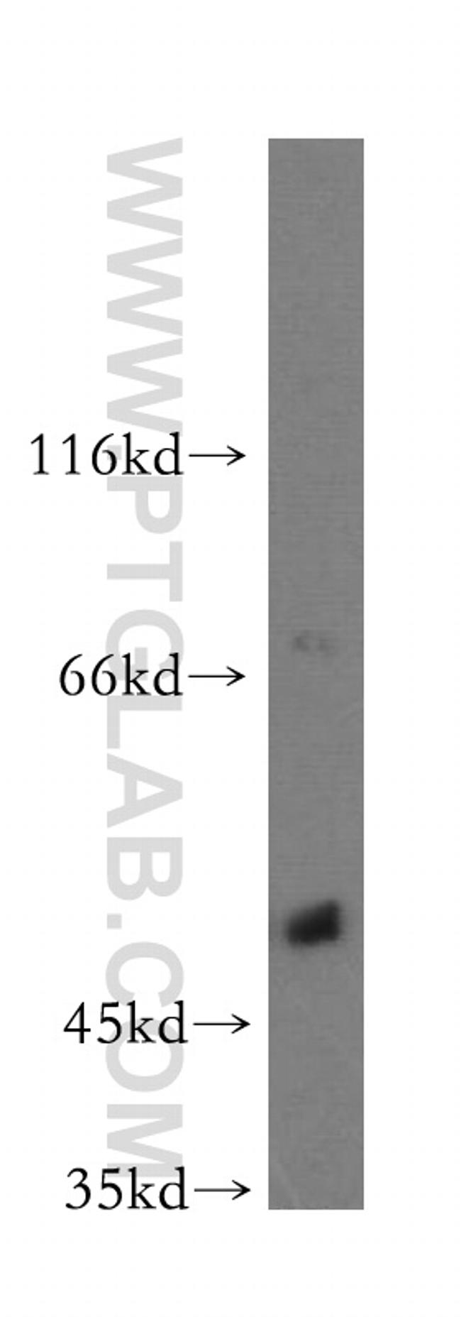 POLM Antibody in Western Blot (WB)