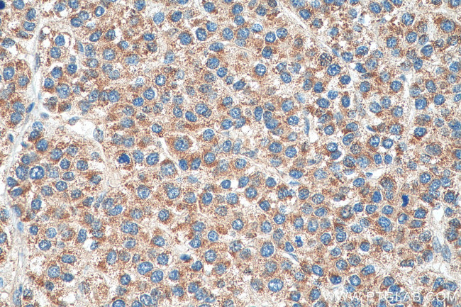 COQ9 Antibody in Immunohistochemistry (Paraffin) (IHC (P))