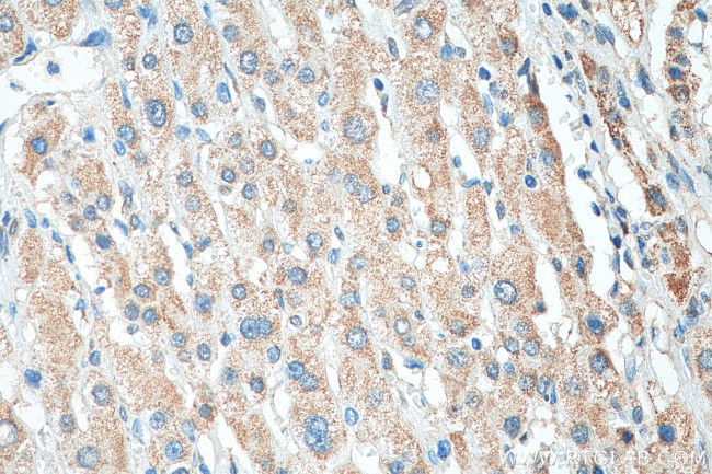 COQ9 Antibody in Immunohistochemistry (Paraffin) (IHC (P))