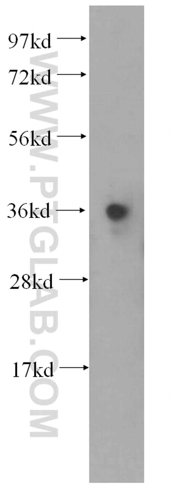 COQ9 Antibody in Western Blot (WB)