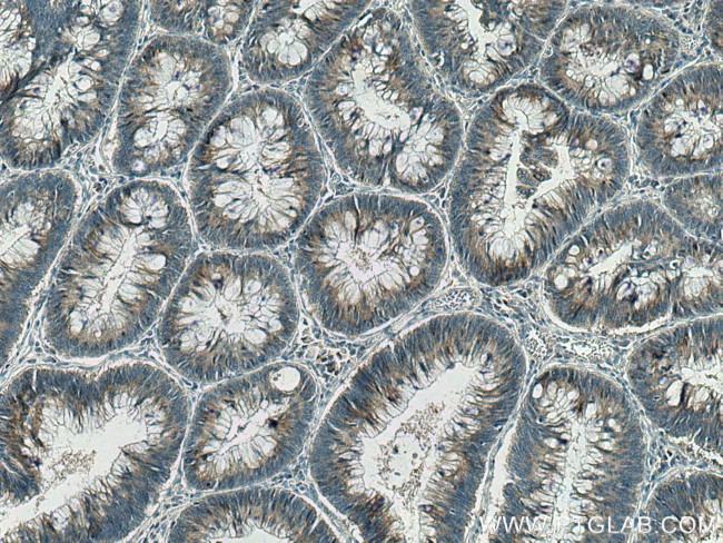 SCLT1 Antibody in Immunohistochemistry (Paraffin) (IHC (P))