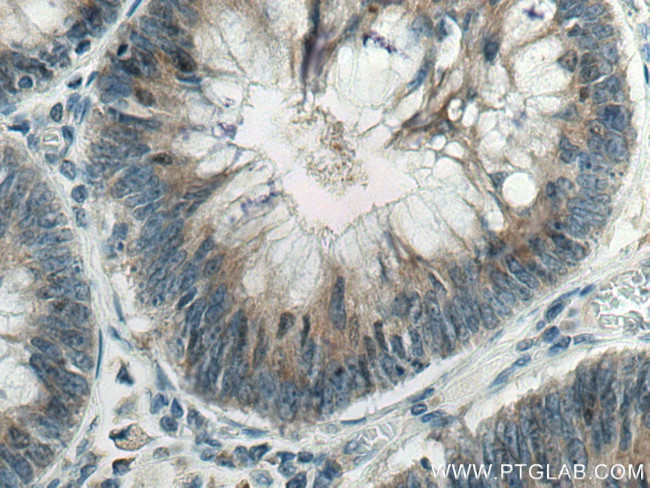 SCLT1 Antibody in Immunohistochemistry (Paraffin) (IHC (P))