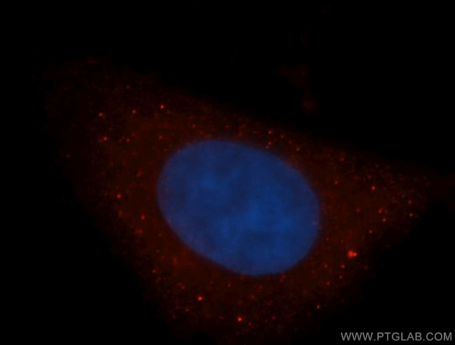 DAAM1 Antibody in Immunocytochemistry (ICC/IF)