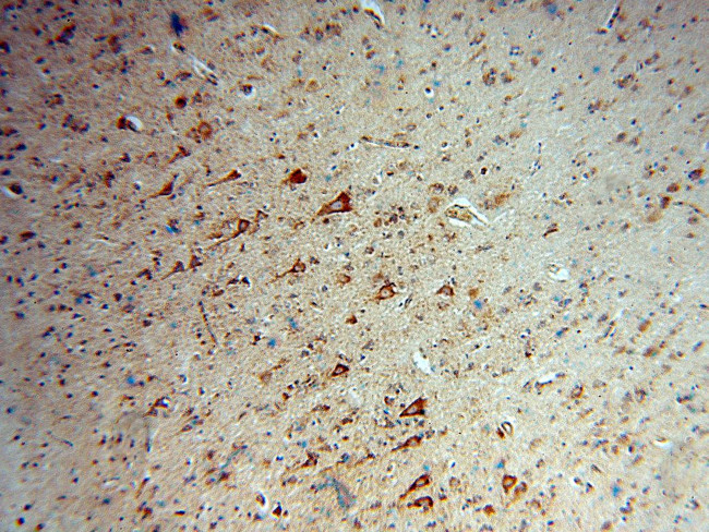 DAAM1 Antibody in Immunohistochemistry (Paraffin) (IHC (P))