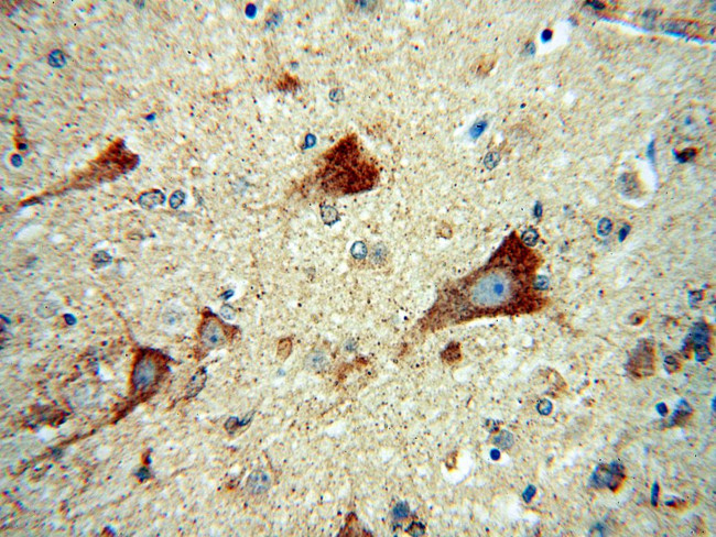 DAAM1 Antibody in Immunohistochemistry (Paraffin) (IHC (P))