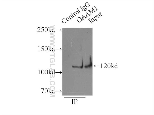 DAAM1 Antibody in Immunoprecipitation (IP)