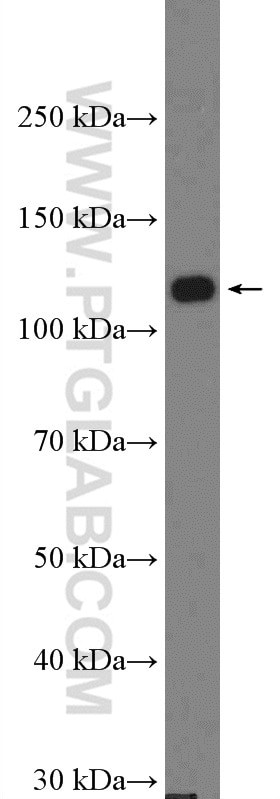 DAAM1 Antibody in Western Blot (WB)