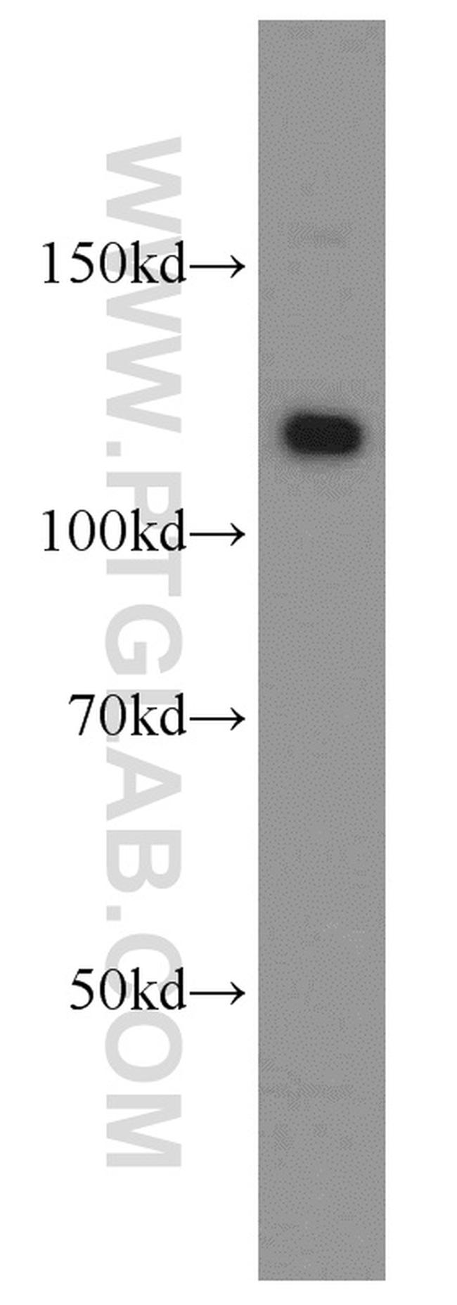 DAAM1 Antibody in Western Blot (WB)