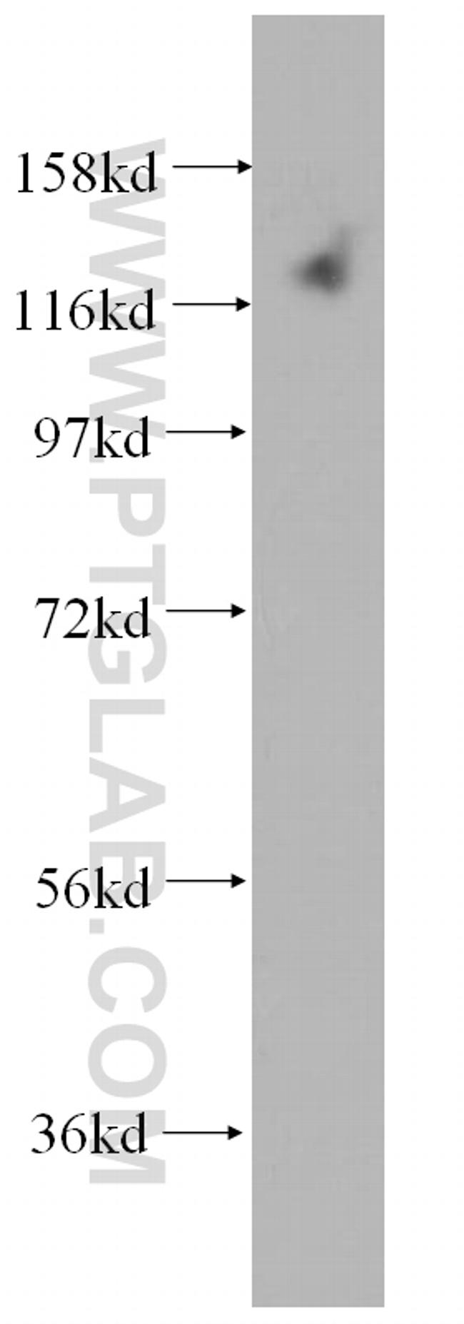 DAAM1 Antibody in Western Blot (WB)