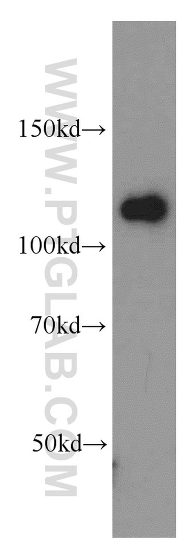 DAAM1 Antibody in Western Blot (WB)