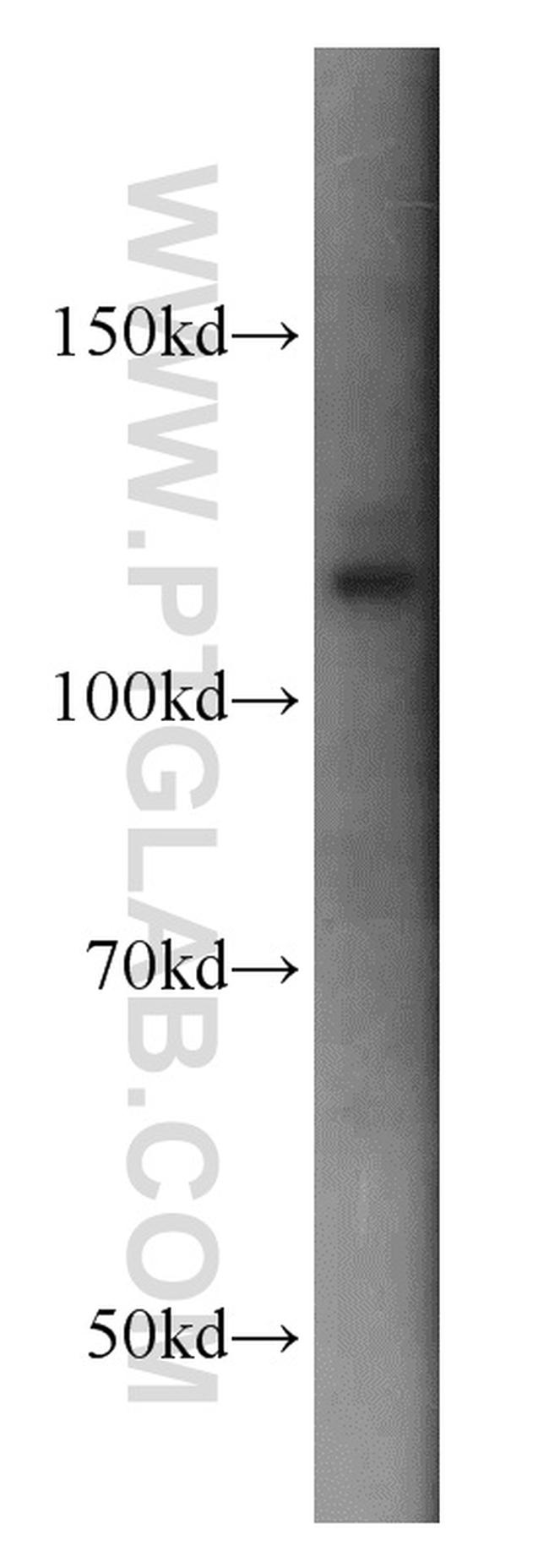 DAAM1 Antibody in Western Blot (WB)