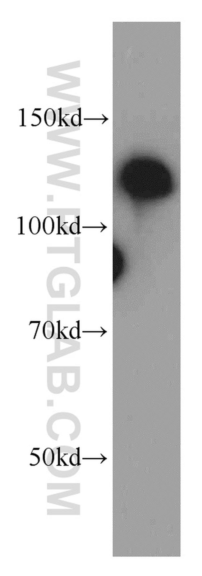 DAAM1 Antibody in Western Blot (WB)