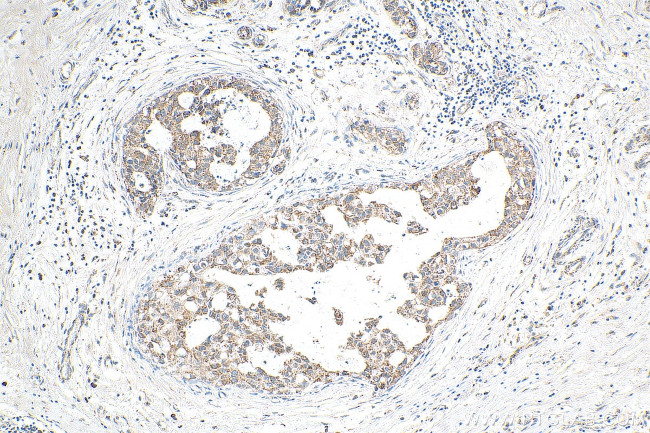 DHODH Antibody in Immunohistochemistry (Paraffin) (IHC (P))