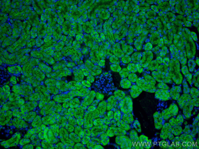 DHODH Antibody in Immunohistochemistry (PFA fixed) (IHC (PFA))