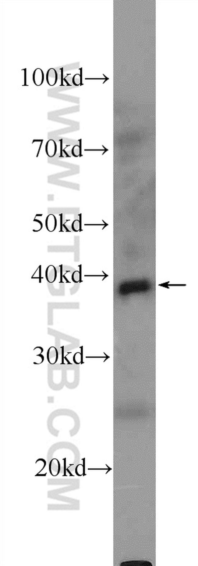 DHODH Antibody in Western Blot (WB)