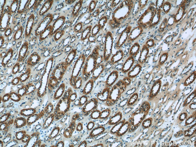 VIPR1 Antibody in Immunohistochemistry (Paraffin) (IHC (P))