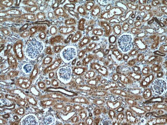 VIPR1 Antibody in Immunohistochemistry (Paraffin) (IHC (P))