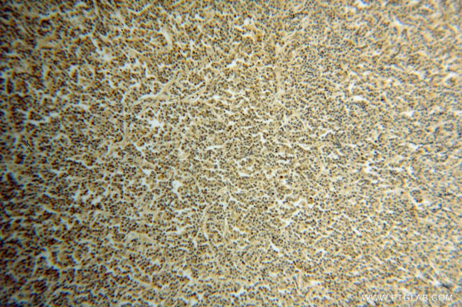 BTG1 Antibody in Immunohistochemistry (Paraffin) (IHC (P))