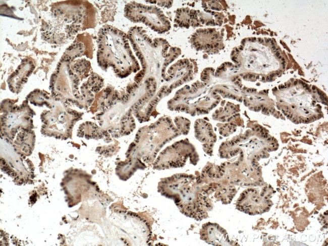 BTG1 Antibody in Immunohistochemistry (Paraffin) (IHC (P))