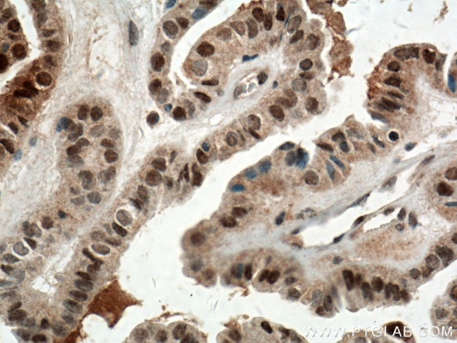 BTG1 Antibody in Immunohistochemistry (Paraffin) (IHC (P))