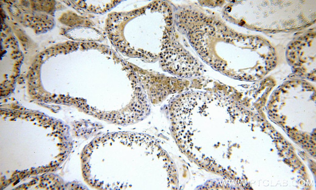 KLHL12 Antibody in Immunohistochemistry (Paraffin) (IHC (P))