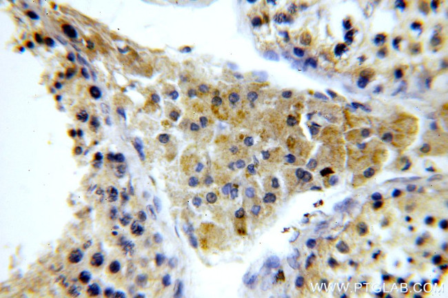 KLHL12 Antibody in Immunohistochemistry (Paraffin) (IHC (P))