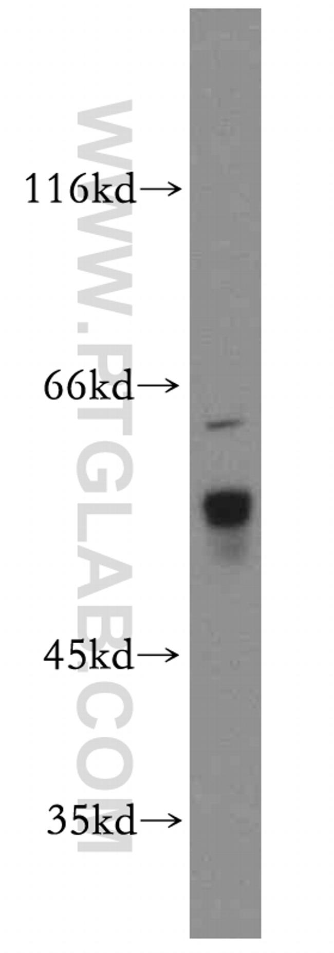 KLHL12 Antibody in Western Blot (WB)