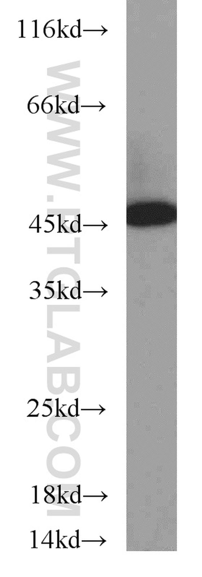 GOT1 Antibody in Western Blot (WB)