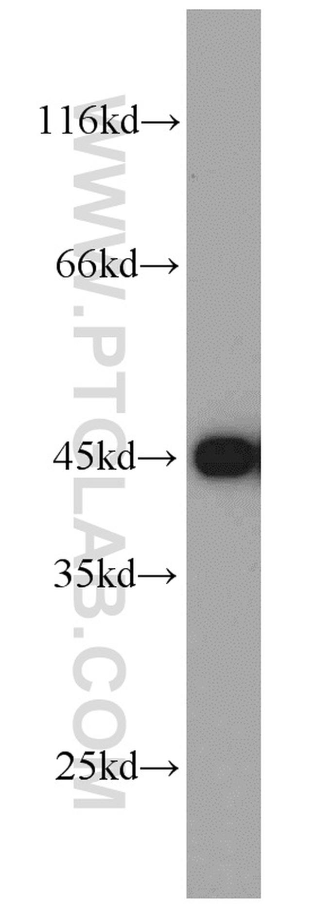 GOT1 Antibody in Western Blot (WB)