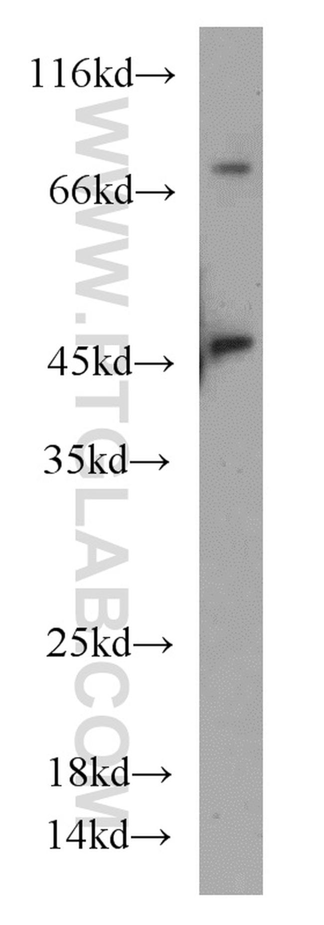 GOT1 Antibody in Western Blot (WB)