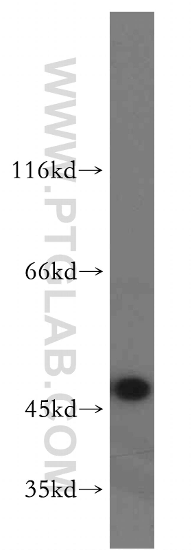 GOT1 Antibody in Western Blot (WB)