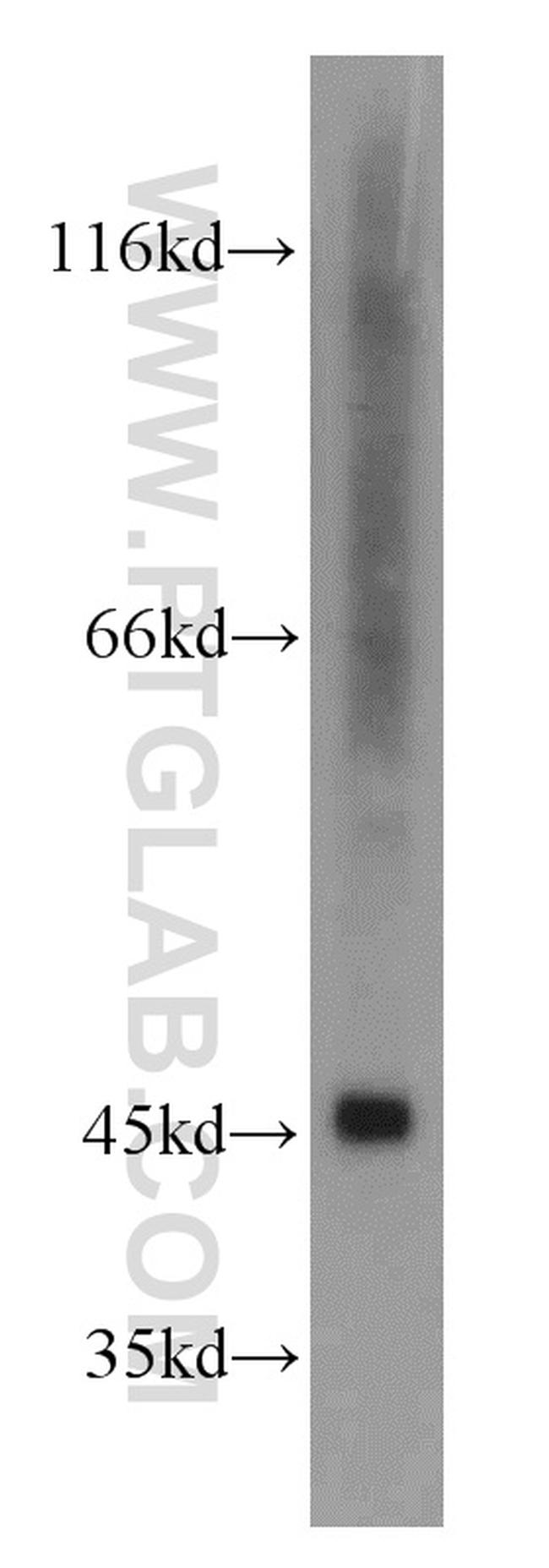 GOT1 Antibody in Western Blot (WB)