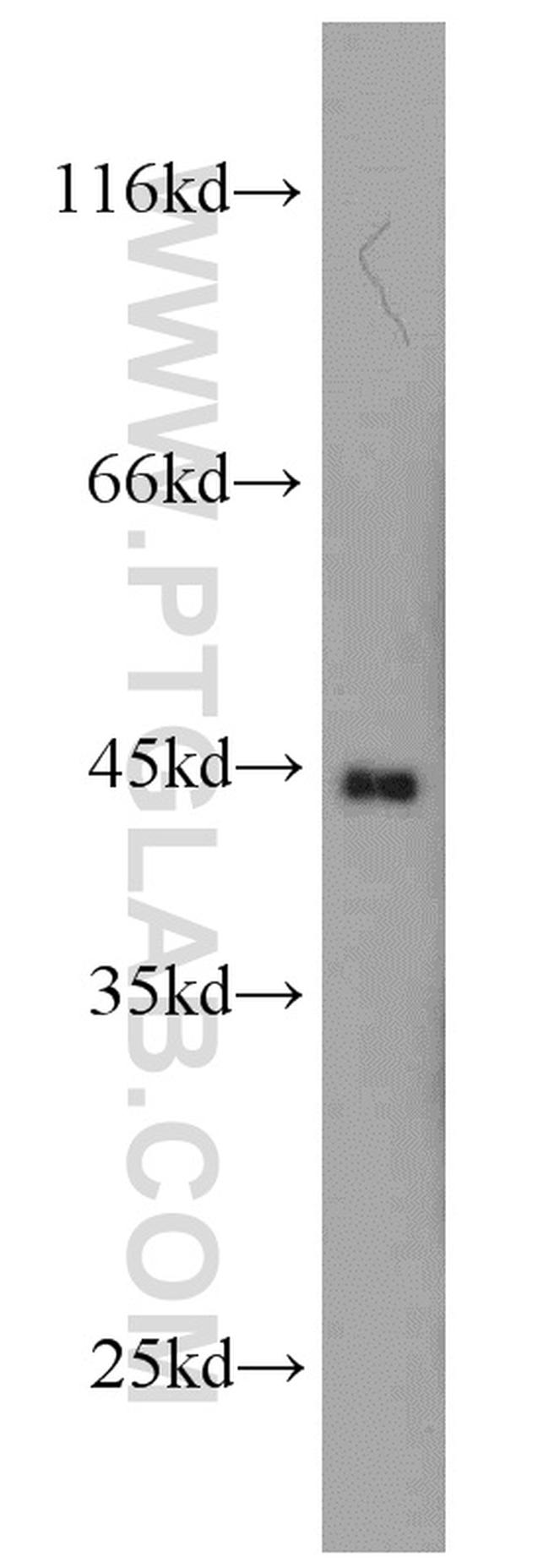 GOT1 Antibody in Western Blot (WB)