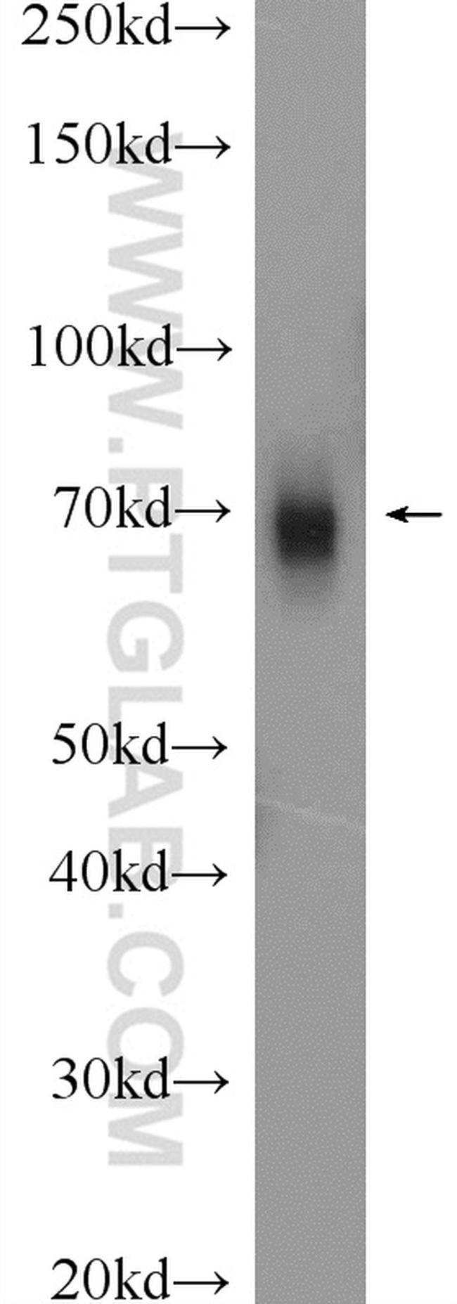 GRP75 Antibody in Western Blot (WB)