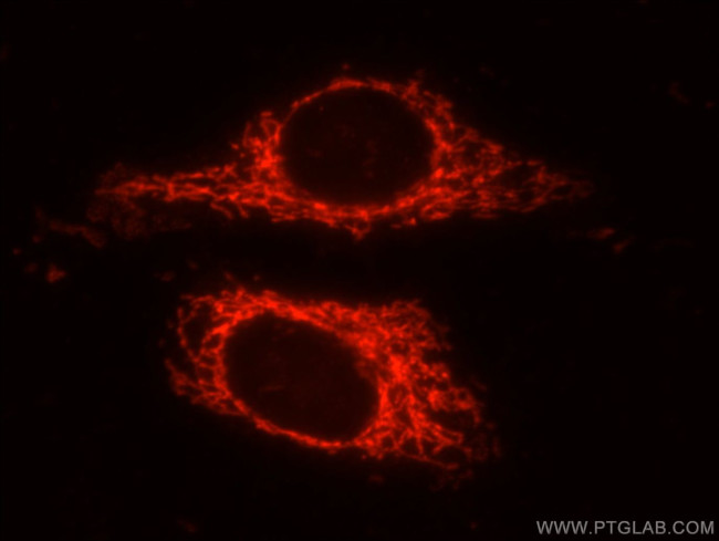 GRP75 Antibody in Immunocytochemistry (ICC/IF)