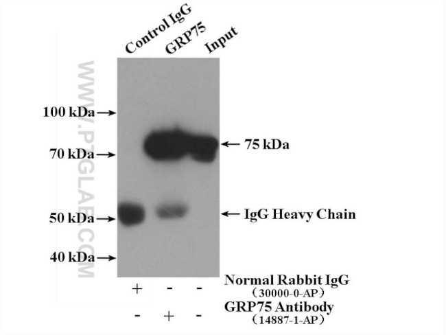 GRP75 Antibody in Immunoprecipitation (IP)