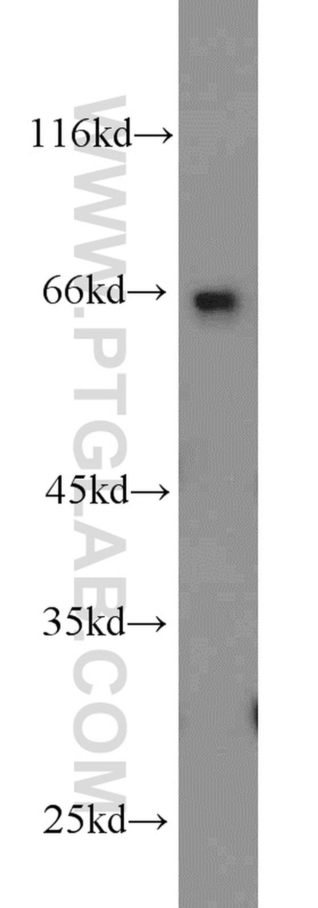 C1orf116 Antibody in Western Blot (WB)