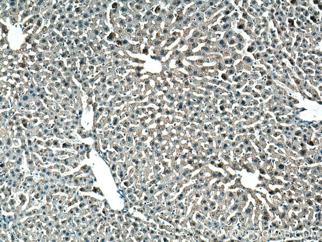 GSTZ1 Antibody in Immunohistochemistry (Paraffin) (IHC (P))