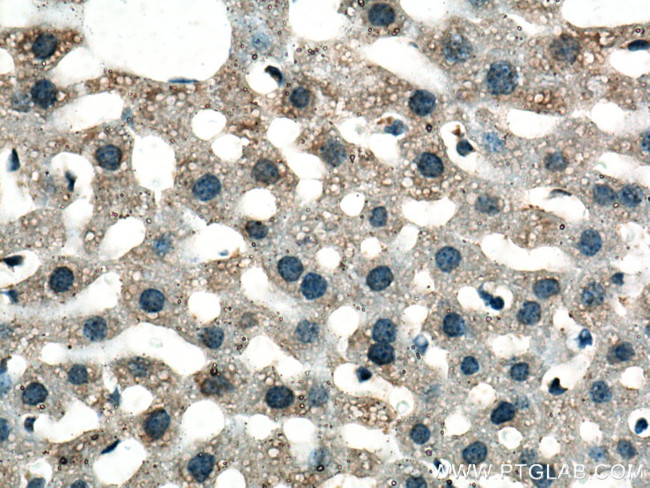 GSTZ1 Antibody in Immunohistochemistry (Paraffin) (IHC (P))