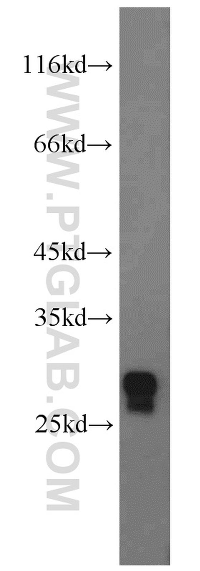 GSTZ1 Antibody in Western Blot (WB)