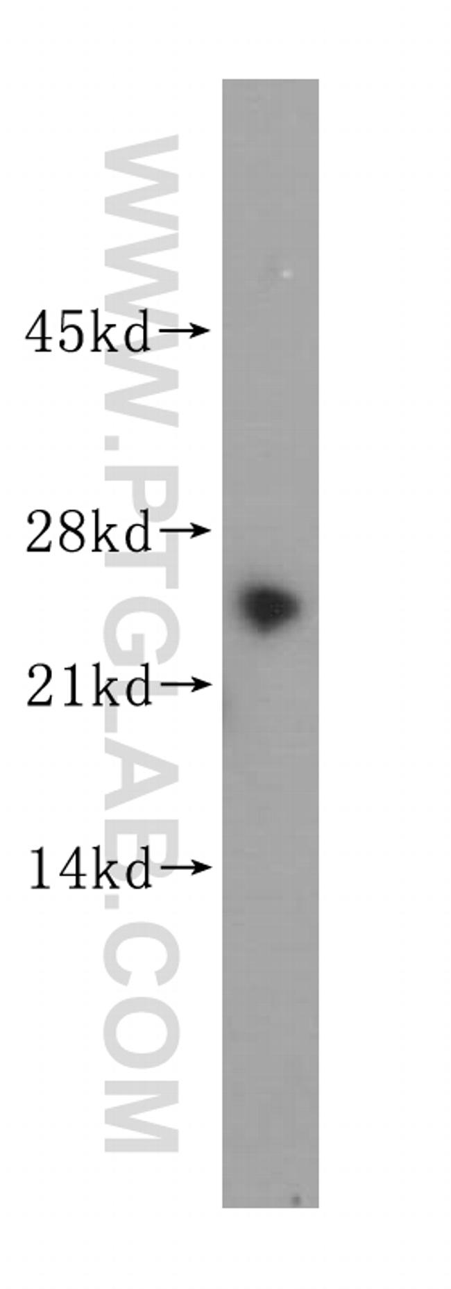 GSTZ1 Antibody in Western Blot (WB)