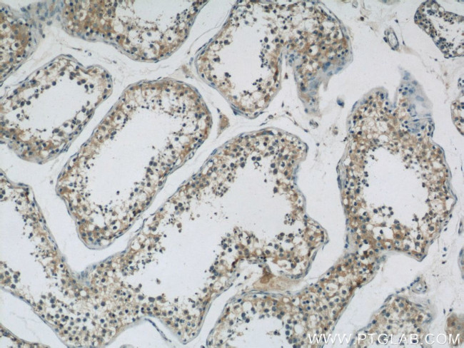 ABI2 Antibody in Immunohistochemistry (Paraffin) (IHC (P))