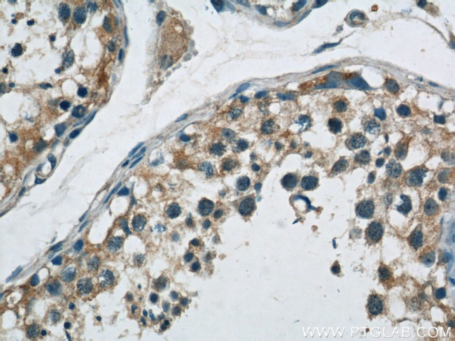 ABI2 Antibody in Immunohistochemistry (Paraffin) (IHC (P))