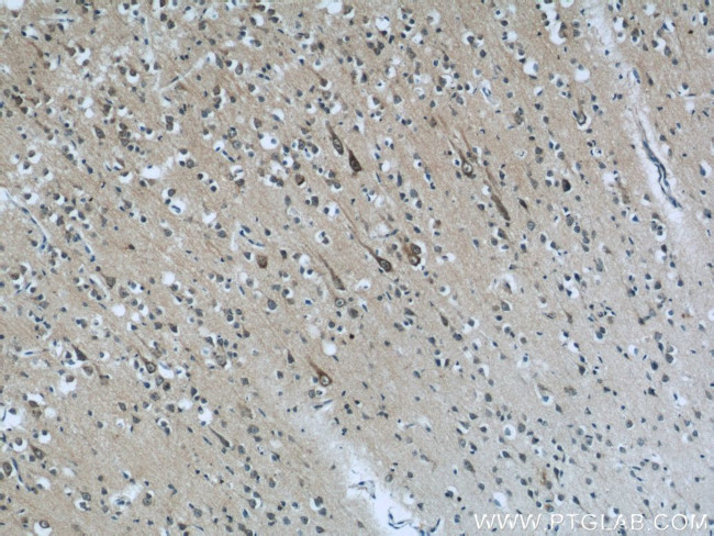 ABI2 Antibody in Immunohistochemistry (Paraffin) (IHC (P))