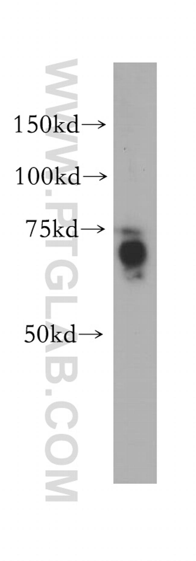 ABI2 Antibody in Western Blot (WB)