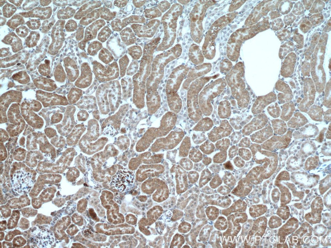 PCK2 Antibody in Immunohistochemistry (Paraffin) (IHC (P))