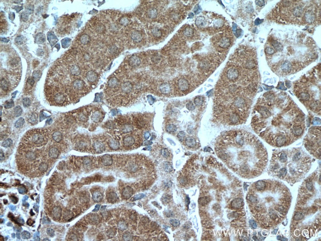 PCK2 Antibody in Immunohistochemistry (Paraffin) (IHC (P))