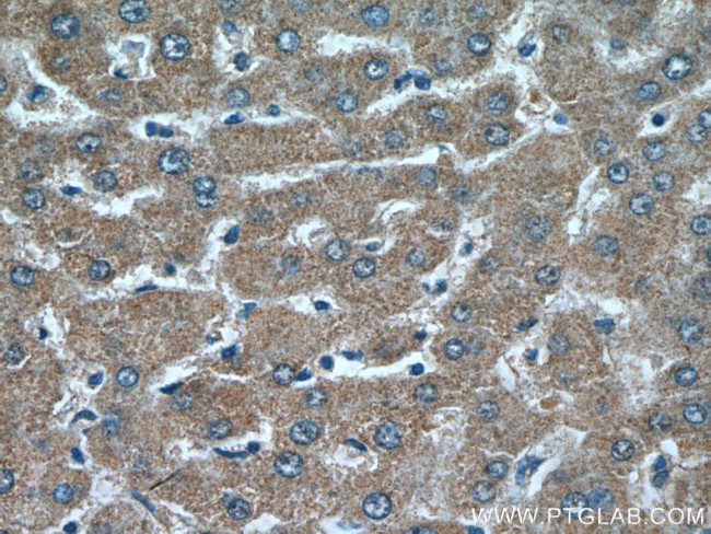 PCK2 Antibody in Immunohistochemistry (Paraffin) (IHC (P))