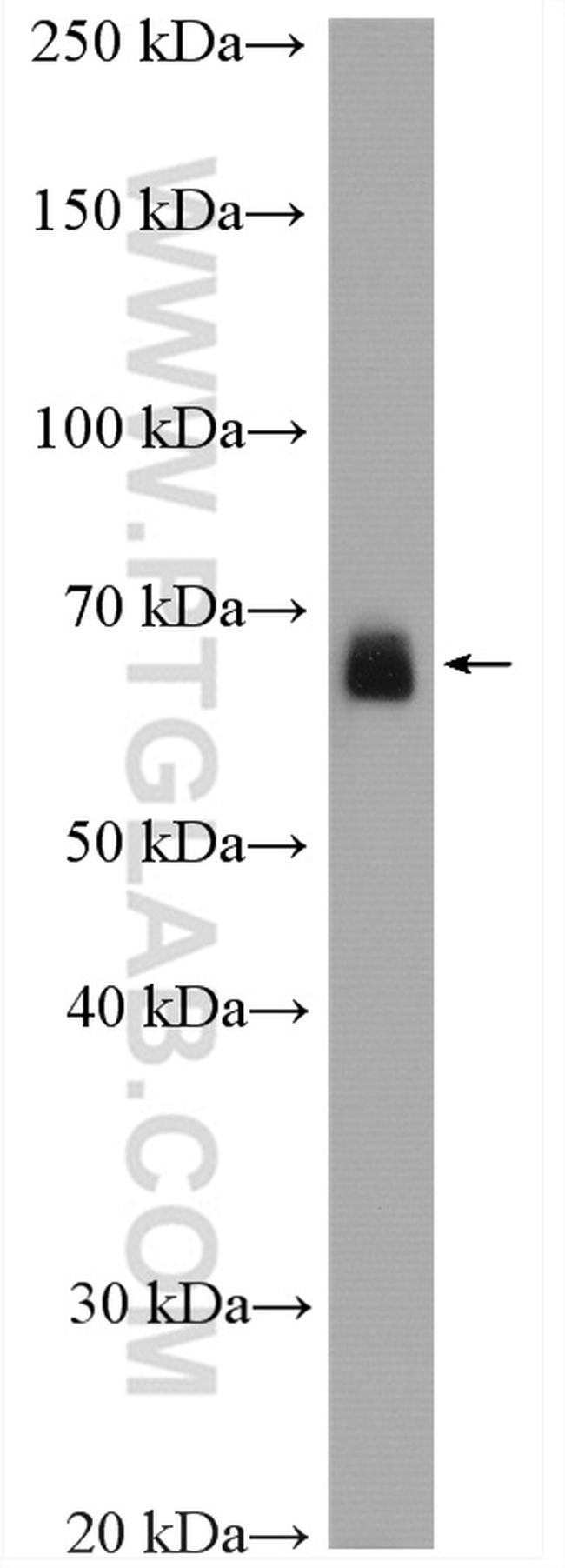 PCK2 Antibody in Western Blot (WB)