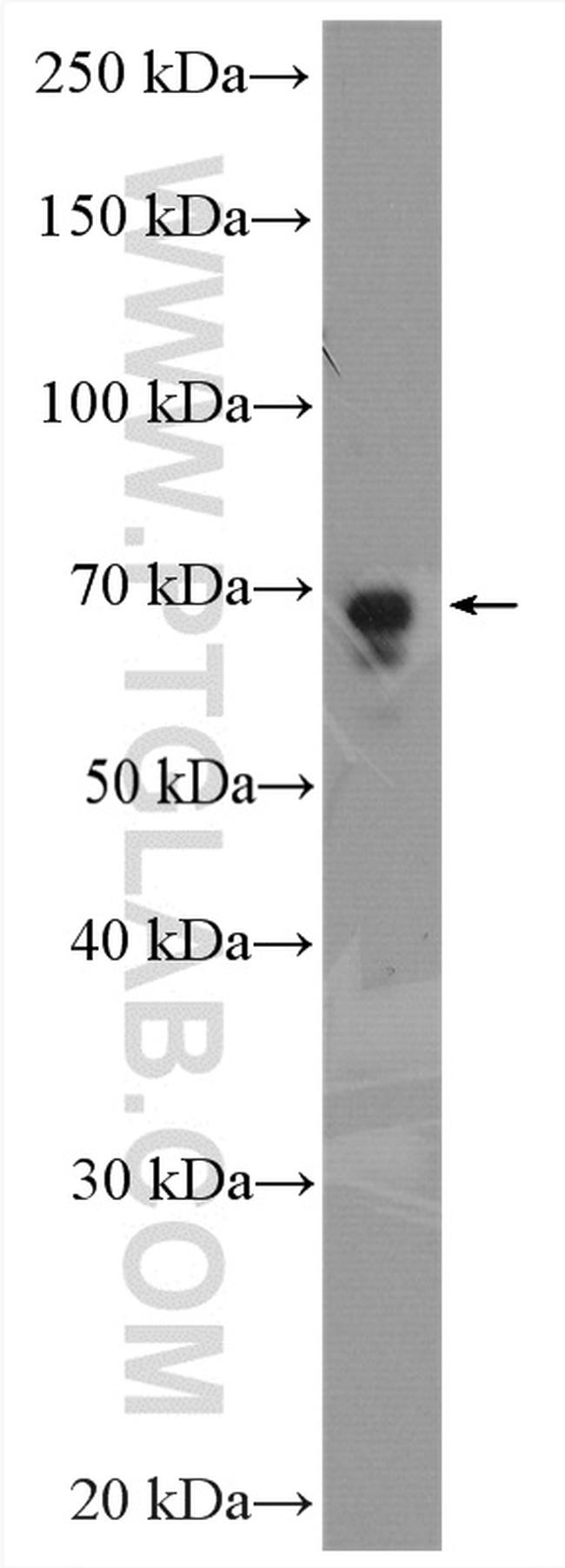 PCK2 Antibody in Western Blot (WB)